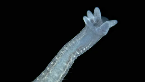 Aulophorus sp worm under a microscope, family Naididae. Stock Footage 236277640