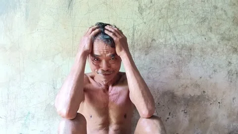 Authentic footage of a thin elderly man holding his head in pain. Stock Footage 317934538