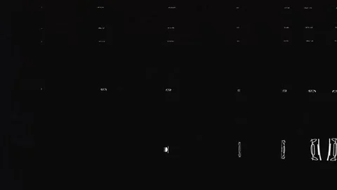 Authentic old film effect with dust, scratches, and static noise. Realistic 8mm Stock Footage 339330252