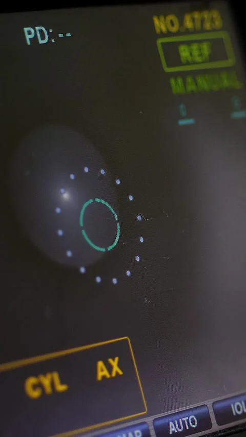 Auto-Ref-Keratometer display with an eye on it. the doctor controls the oculist Stock Footage 317535700