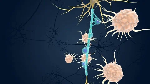 Autoimmune Attack on Myelin Sheath Stock Footage 245279105