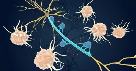 Autoimmune Attack on Myelin Sheath Stock Illustration