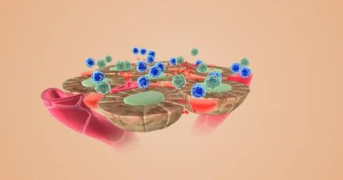 Autoimmune attack on thyroid cells Stock Illustration