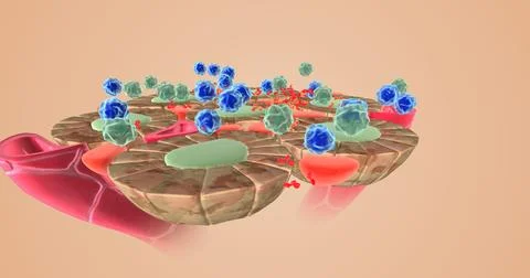 Autoimmune attack on thyroid cells Illustrazione stock