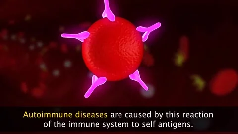 Autoimmune diseases Stock Footage 319703319