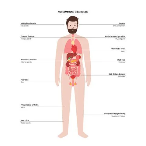 Autoimmune disorders diseases Stock Illustration