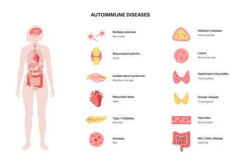 Autoimmune disorders diseases Stock Illustration