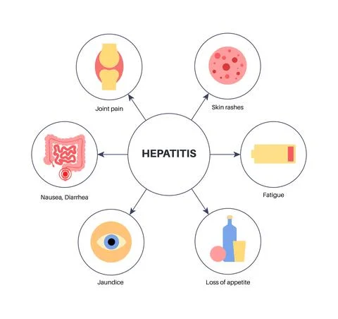 Autoimmune hepatitis disease Stock Illustration