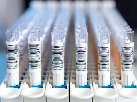 Automated blood sample testing Stockfoto's