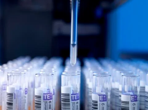 Automated blood sample testing Stock Photos