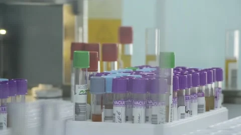 Automated systems for pre and postanalytical processing of samples. Close-up Stock Footage 139063926