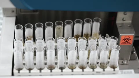 Automated urine analyzer with moving test tubes in medical laboratory. Vídeo Stock 320884941