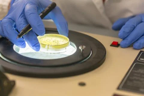 Automatic colony counter 스톡 사진