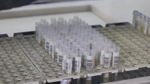 The automatic device in the donor center has plasma tubes on inspection and Stock Footage 304126070