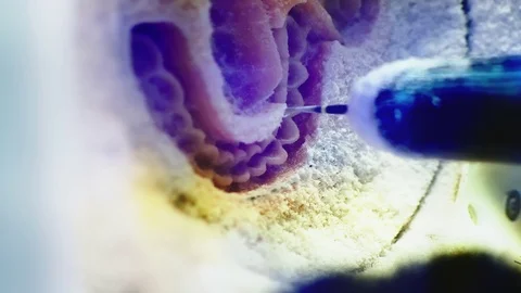 Automatic Process Dental Milling Machine Stock Footage 80036712