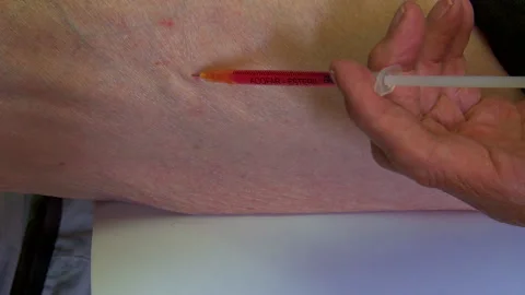 B12 injection Stock Footage 154413917
