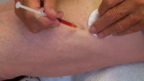 B12 injection Stock Footage 156610286