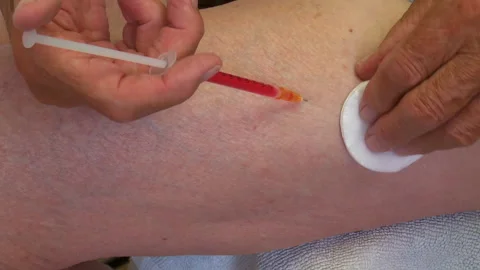 B12 injection Stock Footage 156610310