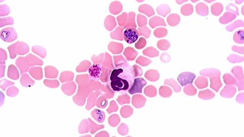 Babesia canis parasite under microscope, Canine blood smear Vídeos de archivo 306591545