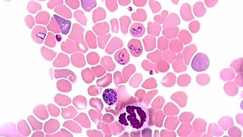 Babesia canis parasite under microscope 1000x, blood smear 库存影片 306591713