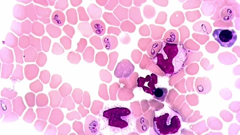 Babesia canis parasite under microscope Vídeos de archivo 306591993