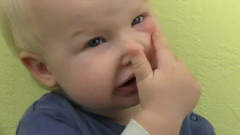 Baby With A Big Mosquito Bite Allergy T Stock Video Pond5