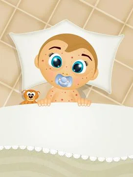 The baby with chickenpox in the bed Stock Illustration