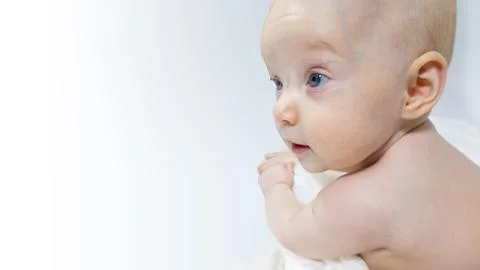A baby with a hemangioma on his neck lies on a white background Stock Photos