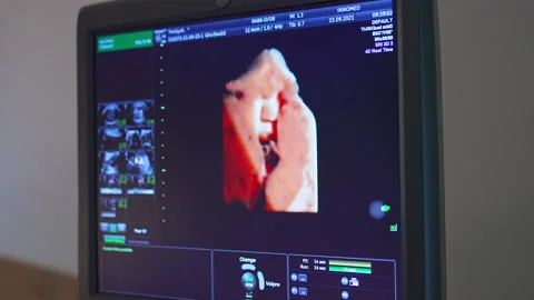 Baby moving in mom’s belly shown at th... | Stock Video | Pond5