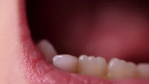 Baby teeth macro shoot. Toothless smile. A wobbly tooth. Cutting root tooth Stock Footage 118825965