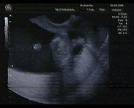 Baby Ultrasound Scan Stock Footage