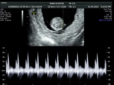 Baby ultrasound scan Stock Footage