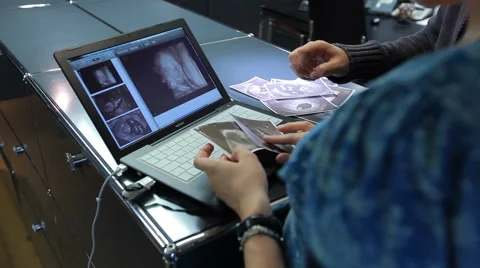 Baby Watching Stock Footage 58856891