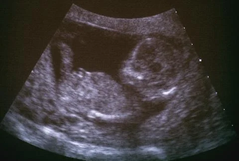 Baby,Beginning,Black Stock Photos