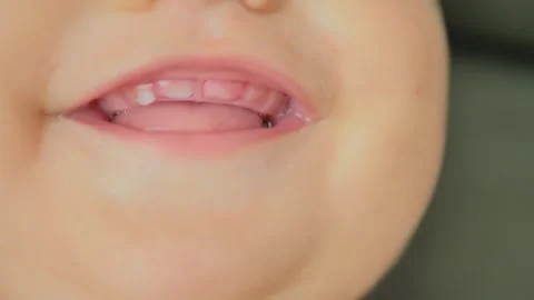 Baby's mouth , the first small teeth Stock Footage 280306347