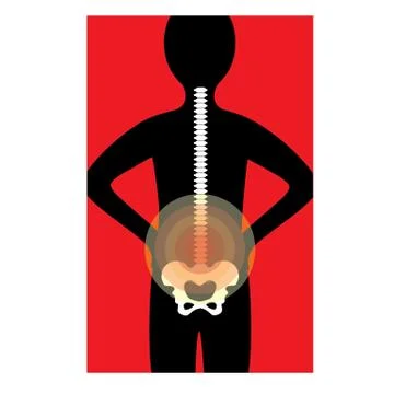 Back Ache Stock Illustration