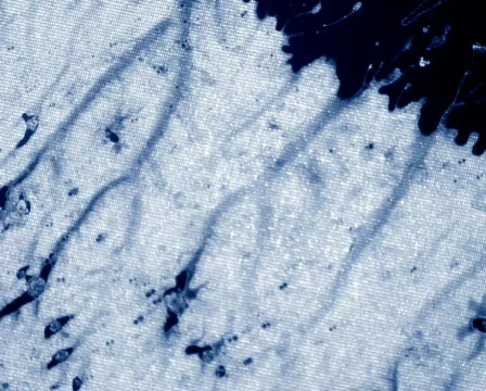 Back and Blue Видео 105023