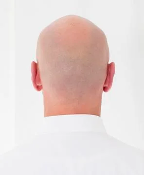 Back of a bald head Stock Photos