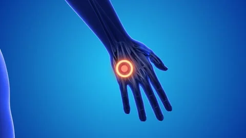 Back hand acupressure  point for relieve wrist pain and headache Stock Footage 250554690
