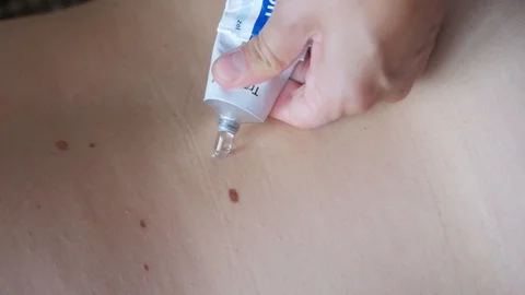 Back lubrication with analgesic ointment Stock Footage 91008645
