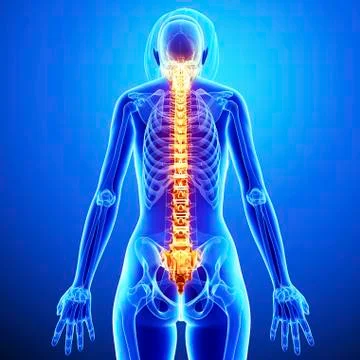 Back pain, artwork Stock Illustration
