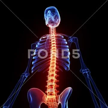 Back pain, artwork Stock Illustration
