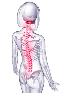 Back pain, artwork Stock Illustration