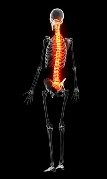 Back pain, artwork Stock Illustration