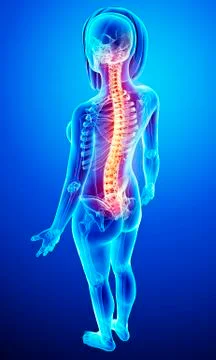 Back pain, artwork Stock Illustration