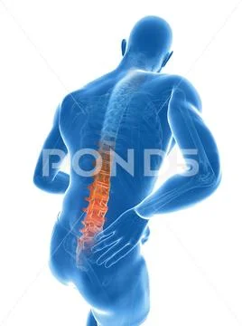 Back pain, artwork Stock Illustration