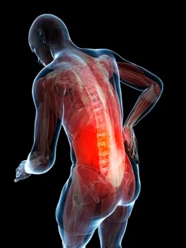 Back pain, artwork Stock Illustration