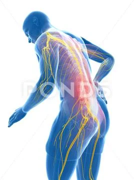 Back pain, artwork Stock Illustration