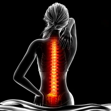 Back pain, artwork Stock Illustration