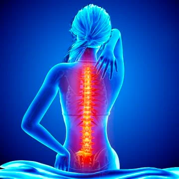 Back pain, artwork Stock Illustration